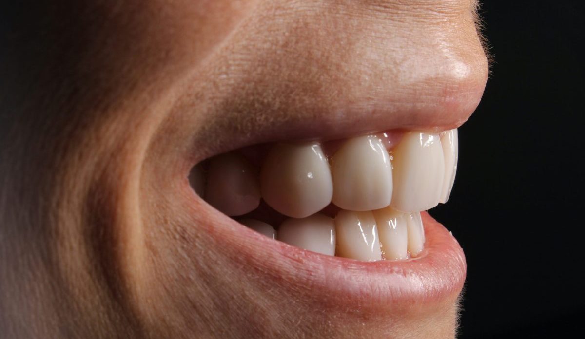 this is pregnant women with sensitive teeth during pregnancy